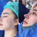 Beyoung Forever Kuasai Pasar Oplas Asia dari Shanghai hingga Tokyo